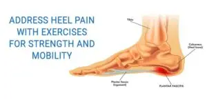 Plantar Fasciitis